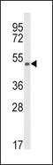 Kynurenine 3-Monooxygenase antibody, PA5-35353, Invitrogen Antibodies, Western Blot image 
