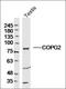 Carbohydrate Sulfotransferase 10 antibody, orb182618, Biorbyt, Western Blot image 