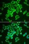 Kelch Like ECH Associated Protein 1 antibody, LS-C331712, Lifespan Biosciences, Immunofluorescence image 