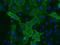 Fms Related Tyrosine Kinase 1 antibody, NB600-1006, Novus Biologicals, Western Blot image 