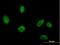 RuvB Like AAA ATPase 2 antibody, H00010856-B01P, Novus Biologicals, Immunocytochemistry image 