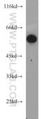 Aldehyde Dehydrogenase 1 Family Member B1 antibody, 22220-1-AP, Proteintech Group, Western Blot image 