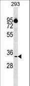 Cytokine Induced Apoptosis Inhibitor 1 antibody, LS-C159353, Lifespan Biosciences, Western Blot image 