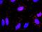 Fibrinogen Gamma Chain antibody, H00002266-M01, Novus Biologicals, Proximity Ligation Assay image 