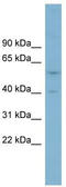 Sushi domain-containing protein 4 antibody, TA342350, Origene, Western Blot image 