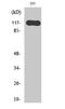 HR Lysine Demethylase And Nuclear Receptor Corepressor antibody, STJ93463, St John