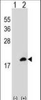 Coactosin Like F-Actin Binding Protein 1 antibody, LS-C166960, Lifespan Biosciences, Western Blot image 