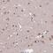 Transcription Factor AP-2 Delta antibody, NBP2-13428, Novus Biologicals, Immunohistochemistry paraffin image 