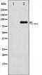 Protein Kinase C Zeta antibody, orb106484, Biorbyt, Western Blot image 