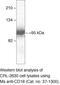 Integrin Subunit Beta 2 antibody, 37-1300, Invitrogen Antibodies, Western Blot image 