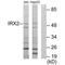 Iroquois Homeobox 2 antibody, A12205, Boster Biological Technology, Western Blot image 