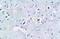 Sodium Voltage-Gated Channel Beta Subunit 1 antibody, orb101522, Biorbyt, Immunohistochemistry paraffin image 