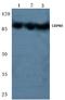 Nuclear Cap Binding Protein Subunit 1 antibody, A07424-2, Boster Biological Technology, Western Blot image 