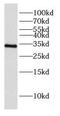Atypical Chemokine Receptor 1 (Duffy Blood Group) antibody, FNab02243, FineTest, Western Blot image 