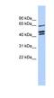 Zinc Finger Protein 578 antibody, NBP1-79370, Novus Biologicals, Western Blot image 