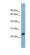 Charged Multivesicular Body Protein 1B antibody, NBP1-55512, Novus Biologicals, Western Blot image 