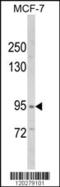 VPS53 Subunit Of GARP Complex antibody, MBS9203617, MyBioSource, Western Blot image 