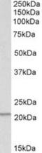 Proteasome subunit beta type-9 antibody, NBP1-52090, Novus Biologicals, Western Blot image 