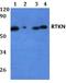 RTKN antibody, A07596, Boster Biological Technology, Western Blot image 