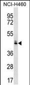 Olfactory Receptor Family 52 Subfamily N Member 5 antibody, PA5-48362, Invitrogen Antibodies, Western Blot image 