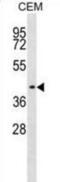 Indian Hedgehog Signaling Molecule antibody, abx025000, Abbexa, Western Blot image 