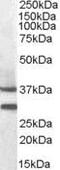 Melanocortin 5 Receptor antibody, PA5-18911, Invitrogen Antibodies, Western Blot image 