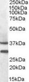 Melanocortin receptor 5 antibody, PA5-18911, Invitrogen Antibodies, Western Blot image 