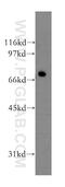 Protein Phosphatase 2 Scaffold Subunit Abeta antibody, 12621-1-AP, Proteintech Group, Western Blot image 