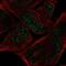 MYCL Proto-Oncogene, BHLH Transcription Factor antibody, NBP2-55735, Novus Biologicals, Immunocytochemistry image 