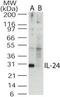 Interleukin-24 antibody, PA1-41066, Invitrogen Antibodies, Western Blot image 
