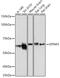 Gasdermin E antibody, GTX64590, GeneTex, Western Blot image 