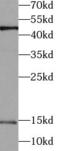 Ubiquitin Conjugating Enzyme E2 A antibody, FNab09163, FineTest, Western Blot image 