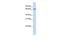 Heterogeneous Nuclear Ribonucleoprotein R antibody, GTX47358, GeneTex, Western Blot image 