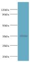 RAD51 Paralog D antibody, MBS1492373, MyBioSource, Western Blot image 