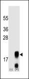 Follicle Stimulating Hormone Subunit Beta antibody, LS-C166262, Lifespan Biosciences, Western Blot image 