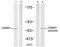 Coactivator Associated Arginine Methyltransferase 1 antibody, PA5-37783, Invitrogen Antibodies, Western Blot image 