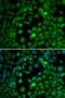 Transcription Factor EB antibody, LS-B14487, Lifespan Biosciences, Immunofluorescence image 