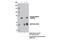 Neurofibromin 2 antibody, 13281S, Cell Signaling Technology, Immunoprecipitation image 