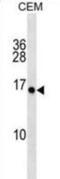 Plasminogen-related protein A antibody, abx030724, Abbexa, Western Blot image 