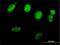 RAD51 Recombinase antibody, H00005888-B01P, Novus Biologicals, Immunofluorescence image 
