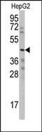 Cellular Communication Network Factor 6 antibody, AP13231PU-N, Origene, Western Blot image 