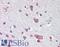 C-X-C Motif Chemokine Receptor 4 antibody, LS-B15344, Lifespan Biosciences, Immunohistochemistry paraffin image 
