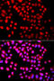 SET Domain Containing 6, Protein Lysine Methyltransferase antibody, STJ29385, St John