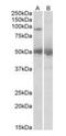 Ubiquitin Specific Peptidase 6 antibody, orb18525, Biorbyt, Western Blot image 