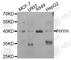 Phytanoyl-CoA dioxygenase, peroxisomal antibody, A6304, ABclonal Technology, Western Blot image 