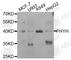 Phytanoyl-CoA 2-Hydroxylase antibody, A6304, ABclonal Technology, Western Blot image 