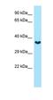 Gap Junction Protein Delta 2 antibody, orb329878, Biorbyt, Western Blot image 