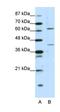 Forkhead Box P4 antibody, orb330082, Biorbyt, Western Blot image 