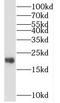 Translocase Of Inner Mitochondrial Membrane 22 antibody, FNab08699, FineTest, Western Blot image 
