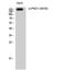 Protein Kinase D1 antibody, STJ90492, St John